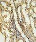 TRAP Antibody (N-term)